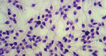 Показатели расшифровки спермограммы