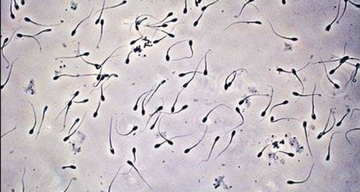 Беременность при тератозооспермии