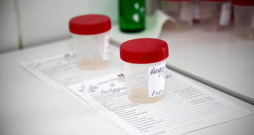 Анализ спермограммы ЭМИС